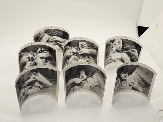 Vintage Original Surgery Operation Photos 1964 Black & White Set Of 7 